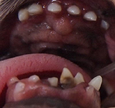 ゆずちゃん　犬の歯石除去2